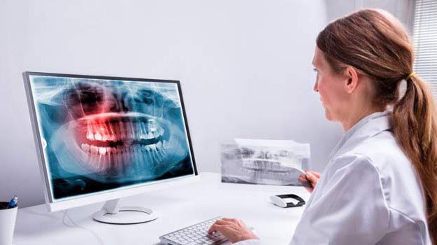 Digital X-Rays Farmington Hills Mi