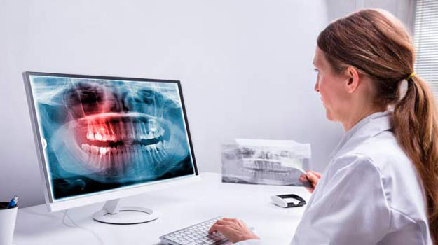A Female Dentist Looking At Teeth X-ray On Computer