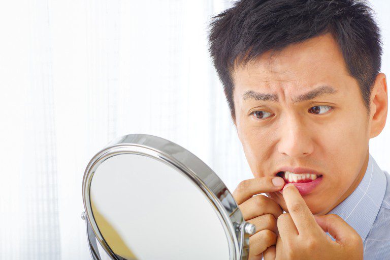 Family Dentist on Canker and Cold Sores
