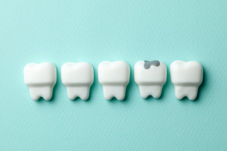 High Fillings Farmington Hills