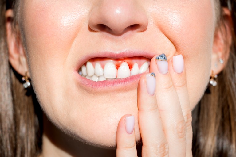 Gum Disease Farmington Hills