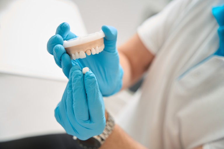 High-Quality Dental Crowns and Fixed Dental Bridges