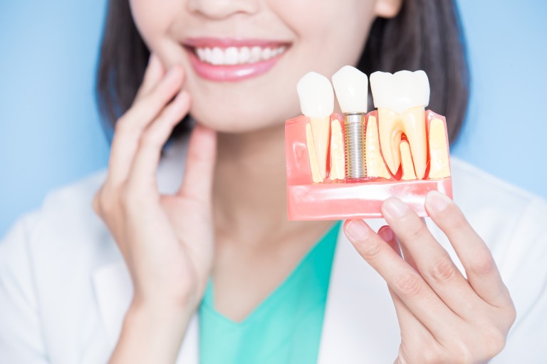 Our Detroit Implant Dentist Can Help