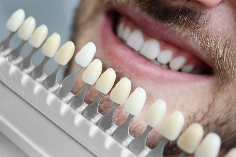 Tooth Replacement Options in Farmington Hills