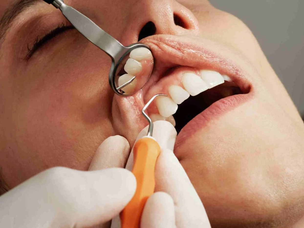 Picture of a Patient Checking His Teeth by a Dentist